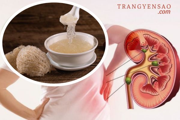 Suy thận có ăn yến được không?